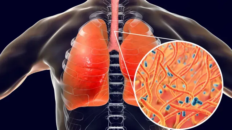 Hangi ilaçlar öksürüğe neden oluyor? işte bilmeniz gerekenler