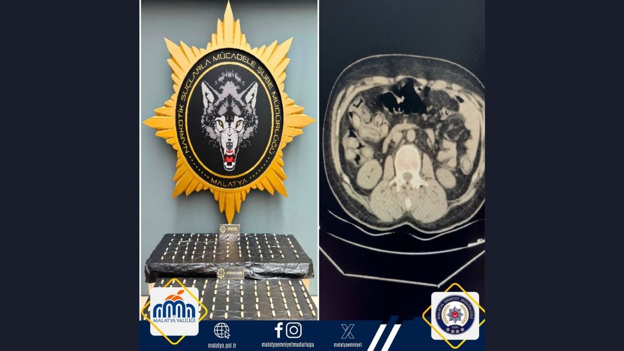 Malatya’da Akıl Almaz Sevkiyat Kuryelerin Midesi Uyuşturucu Deposu Çıktı (3) Malatyahaber