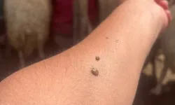 Kene popülasyonu arttı, uzmanlar tedbir çağrısı yaptı