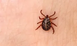 Kene Isırması Belirtileri Nelerdir, Kene Vücuttan Nasıl Çıkarılır? Uzmanlardan Ölümcül Kene Uyarısı